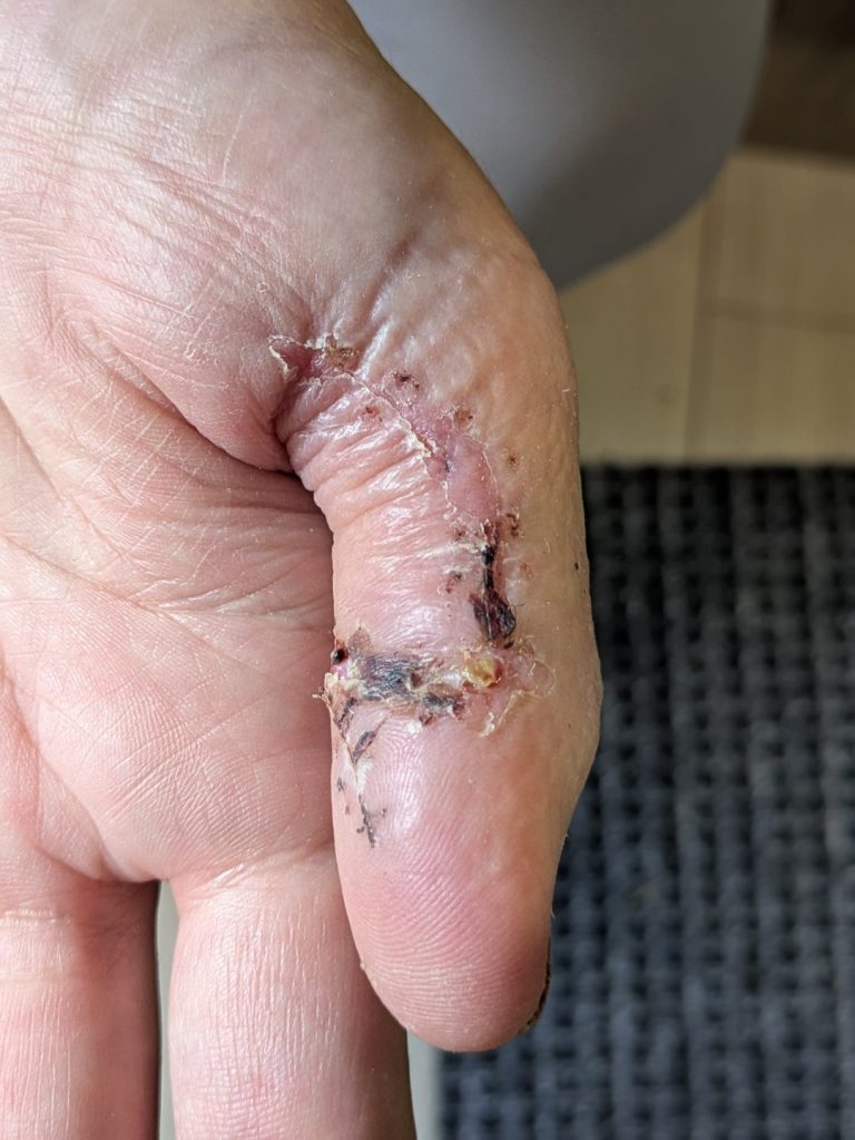 Joe Thumb